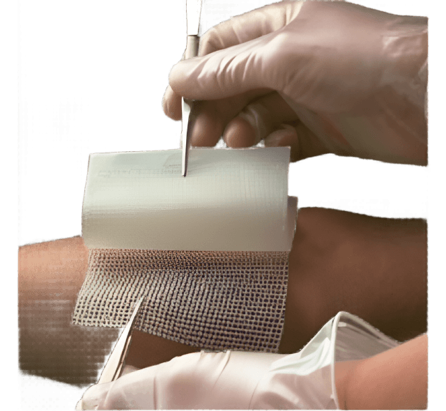 Smith & Nephew Bactigras Total Antiseptic